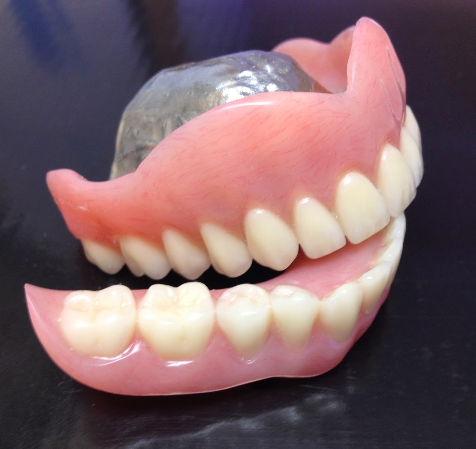 Le blogue Michel Puertas denturologiste: Prótesis Dentales Completas