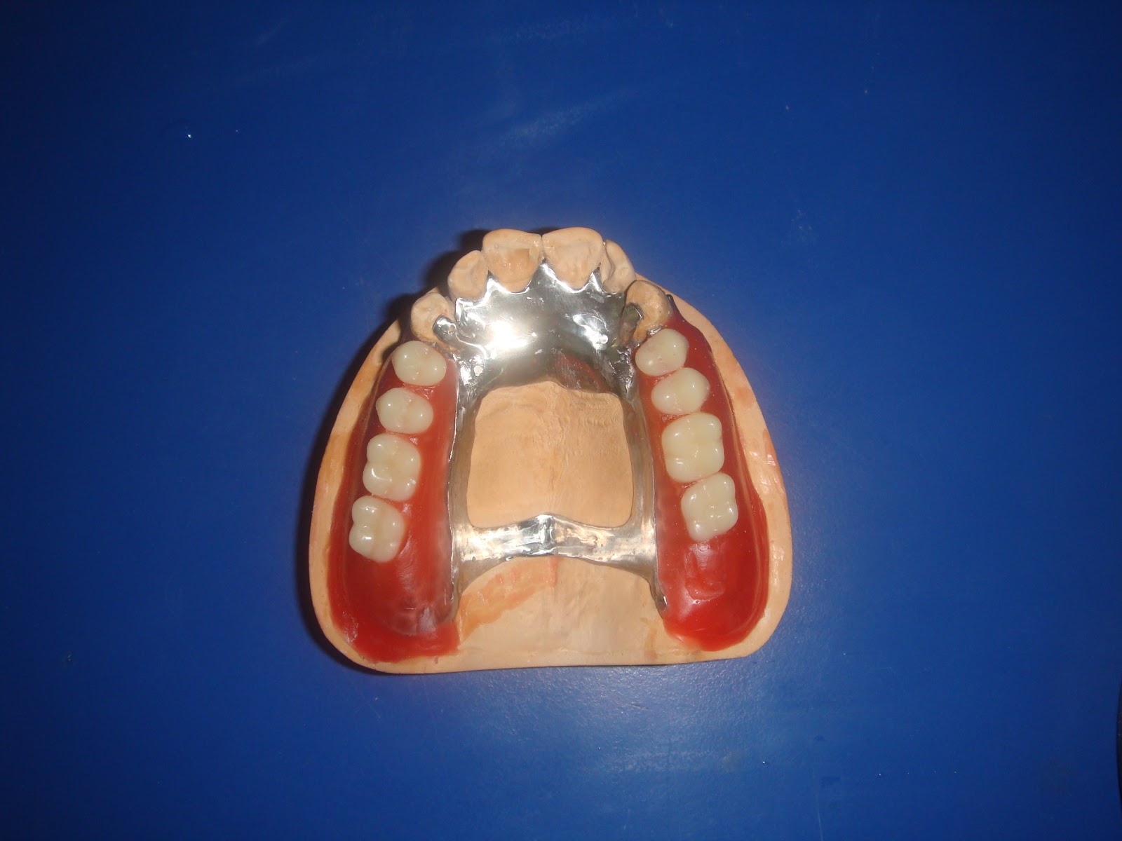 Step by step Guide for Understanding the Prosthodontics A step by step