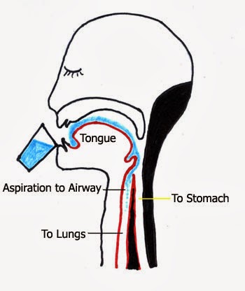 ICD 9 Code For Dysphagia