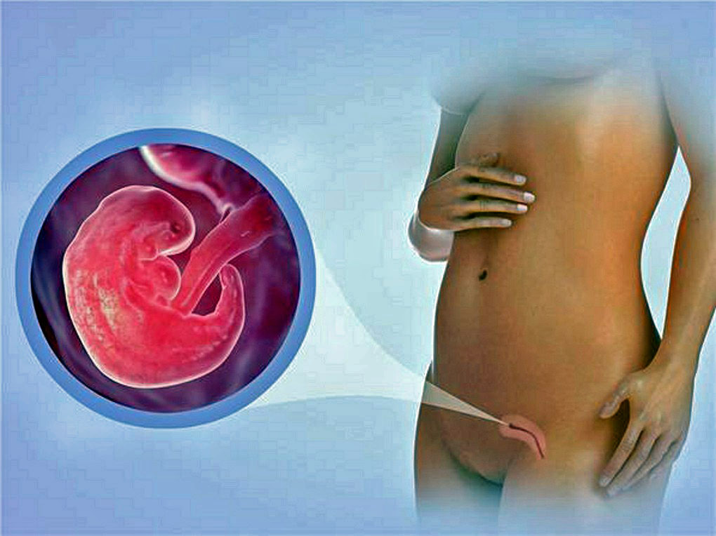 schwanger ziehen mutterbänder