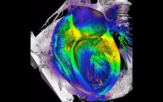 Investigadores han reconstruido mediante poderosos rayos X a los culpables de la arritmia cardiaca en acción  Investigadores+han+reconstruido+mediante+poderosos+rayos+X+a+los+culpables+de+la+arritmia+cardiaca+en+acci%C3%B3n