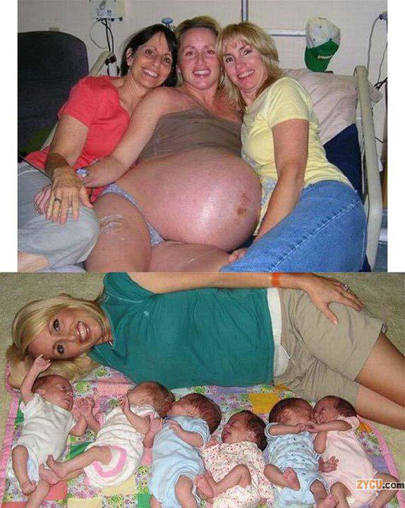 Images Of Women Pregnant With Sextuplets 42