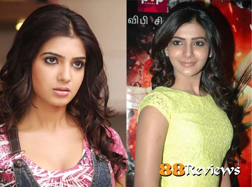 Nirupama shyam: Plastic Surgery Gone Wrong