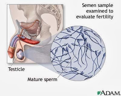 What causes sperm to be watery?
