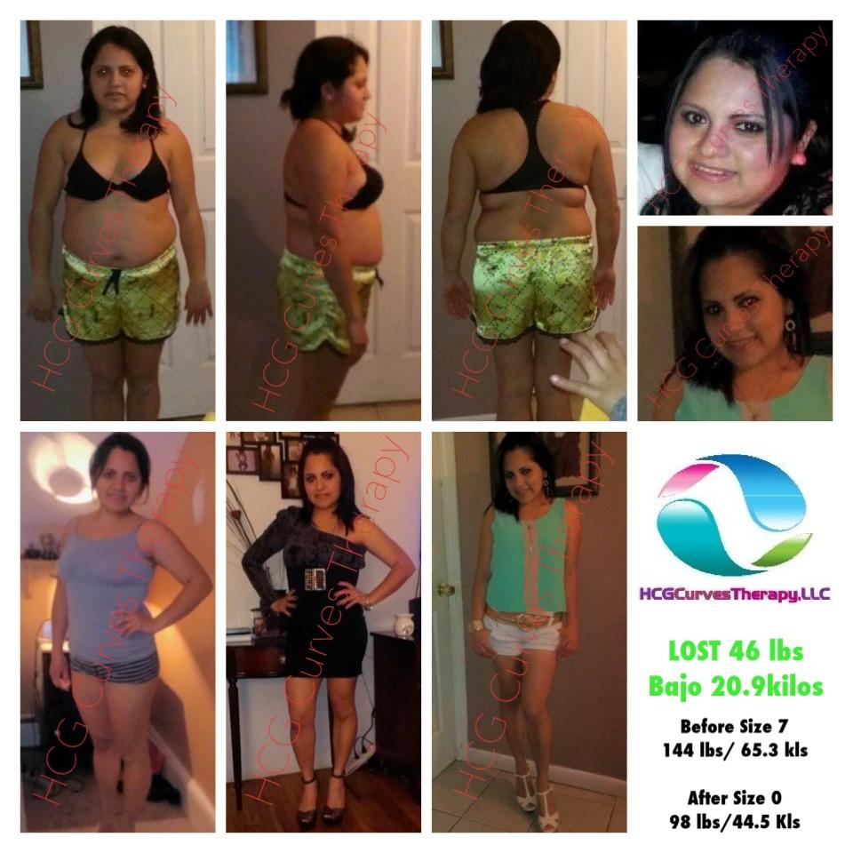 RESULTADOS ANTES Y DESPUES DE LA DIETA HCG