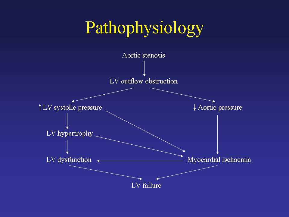 Medical Lecture Notes Online: Valvular Heart Disease