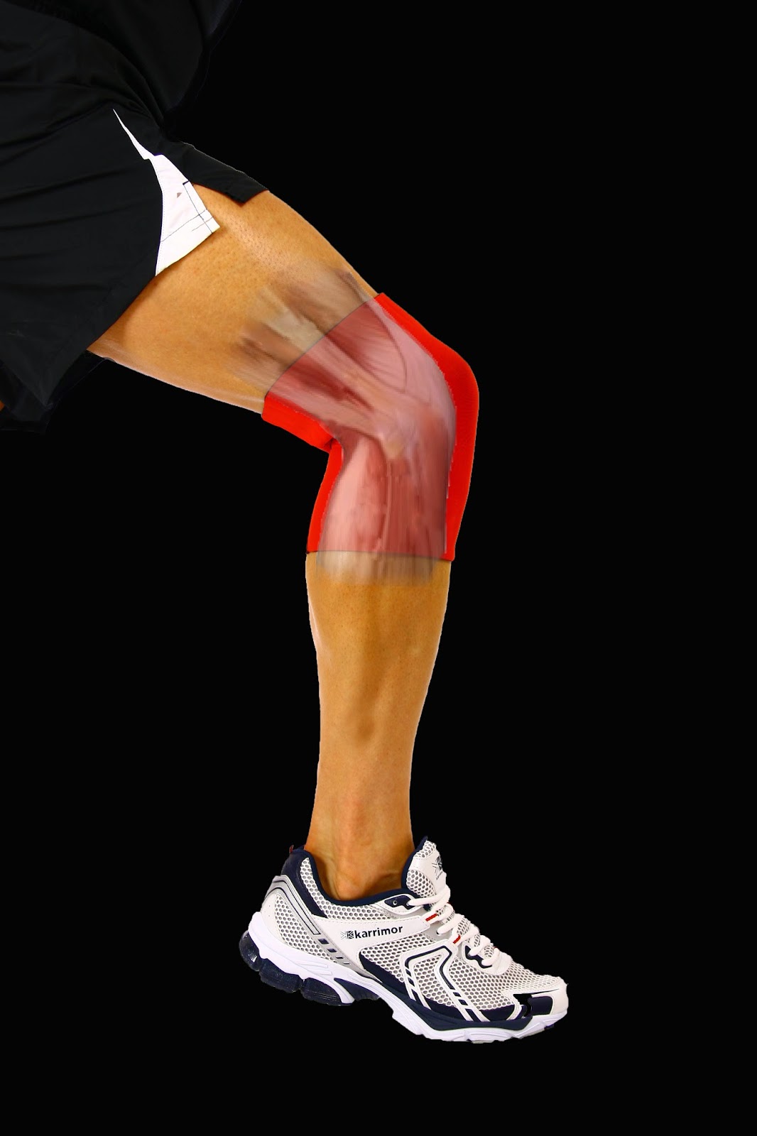Knee Pain - Running with Knee Pain