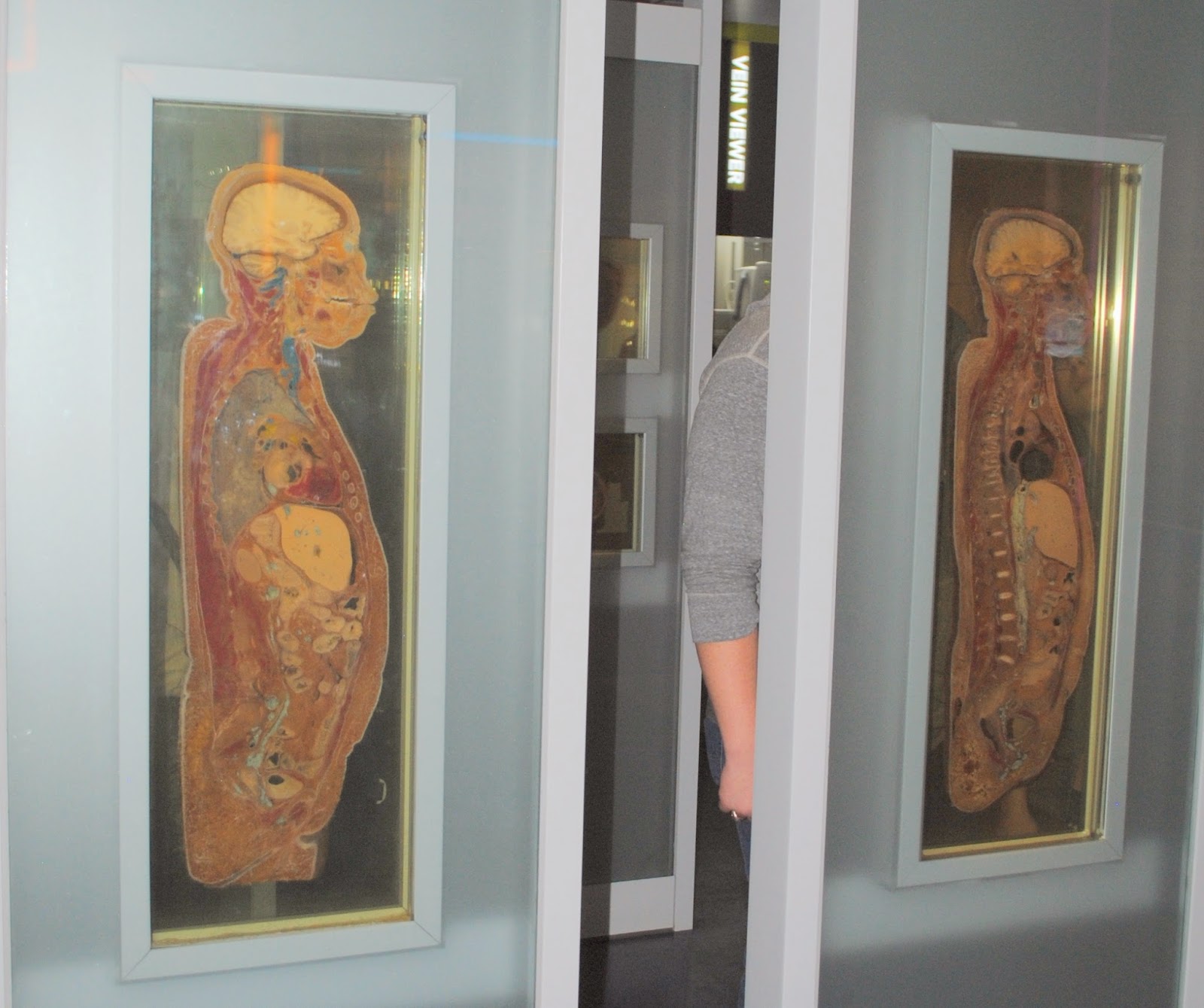 The Carpetbagger Return of the Body Slices