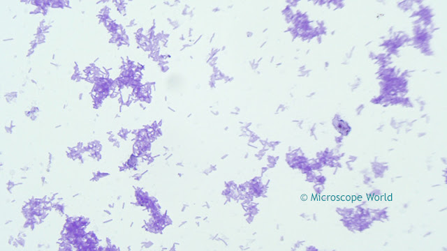 Microscopy image of Clostridium Tetani, the bacteria that causes Tetanus at 400x.