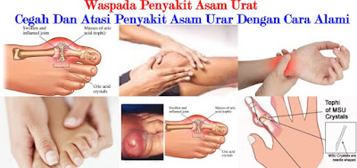 obat asam urat china