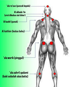 Titik Bekam Sunnah Nabi