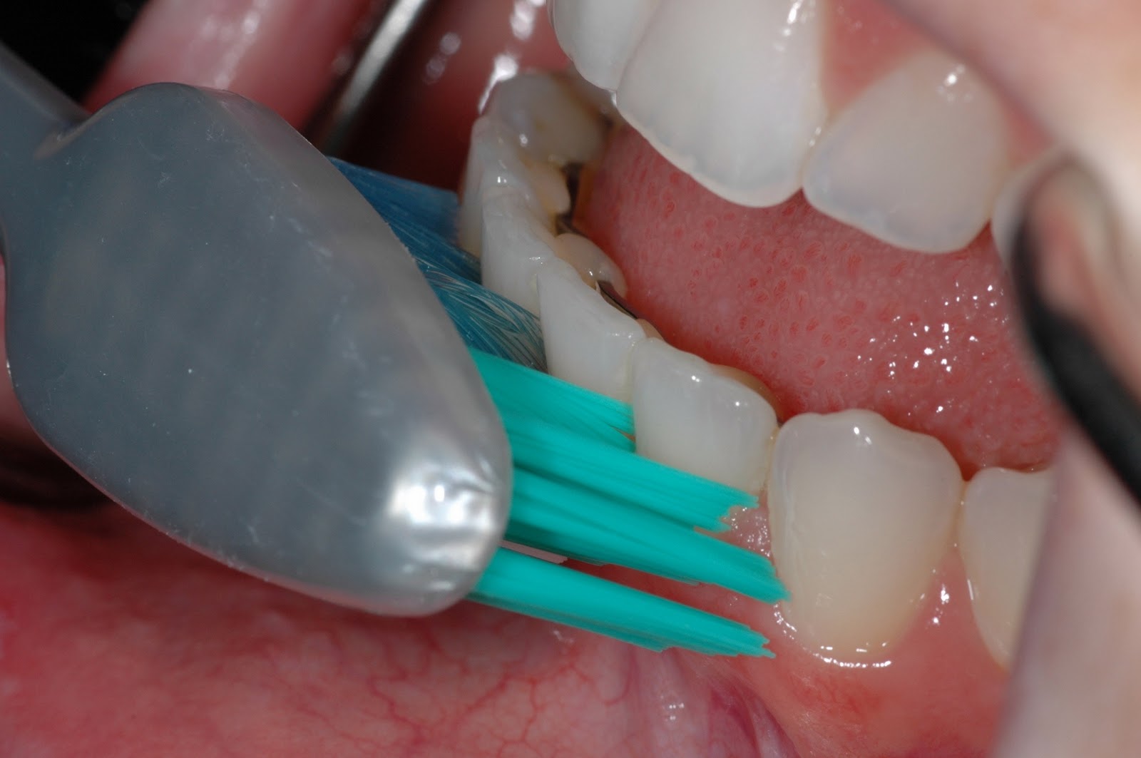 The Buzz from Your Favorite Dental Hygienists April 2011