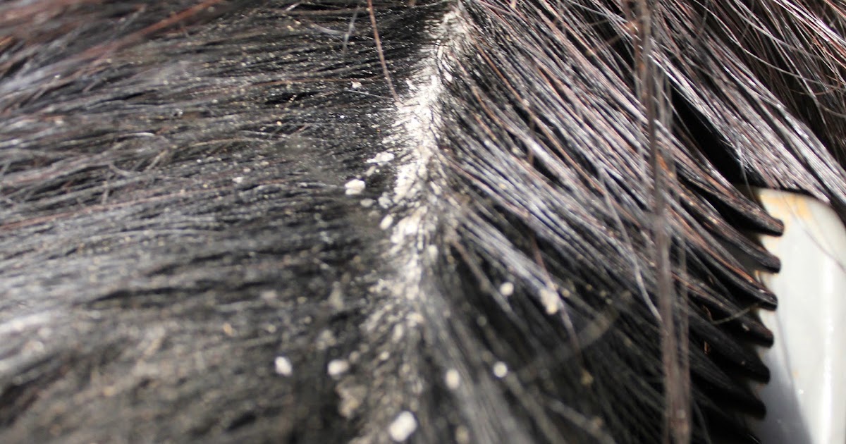 Just Horses Dander White Vinegar?