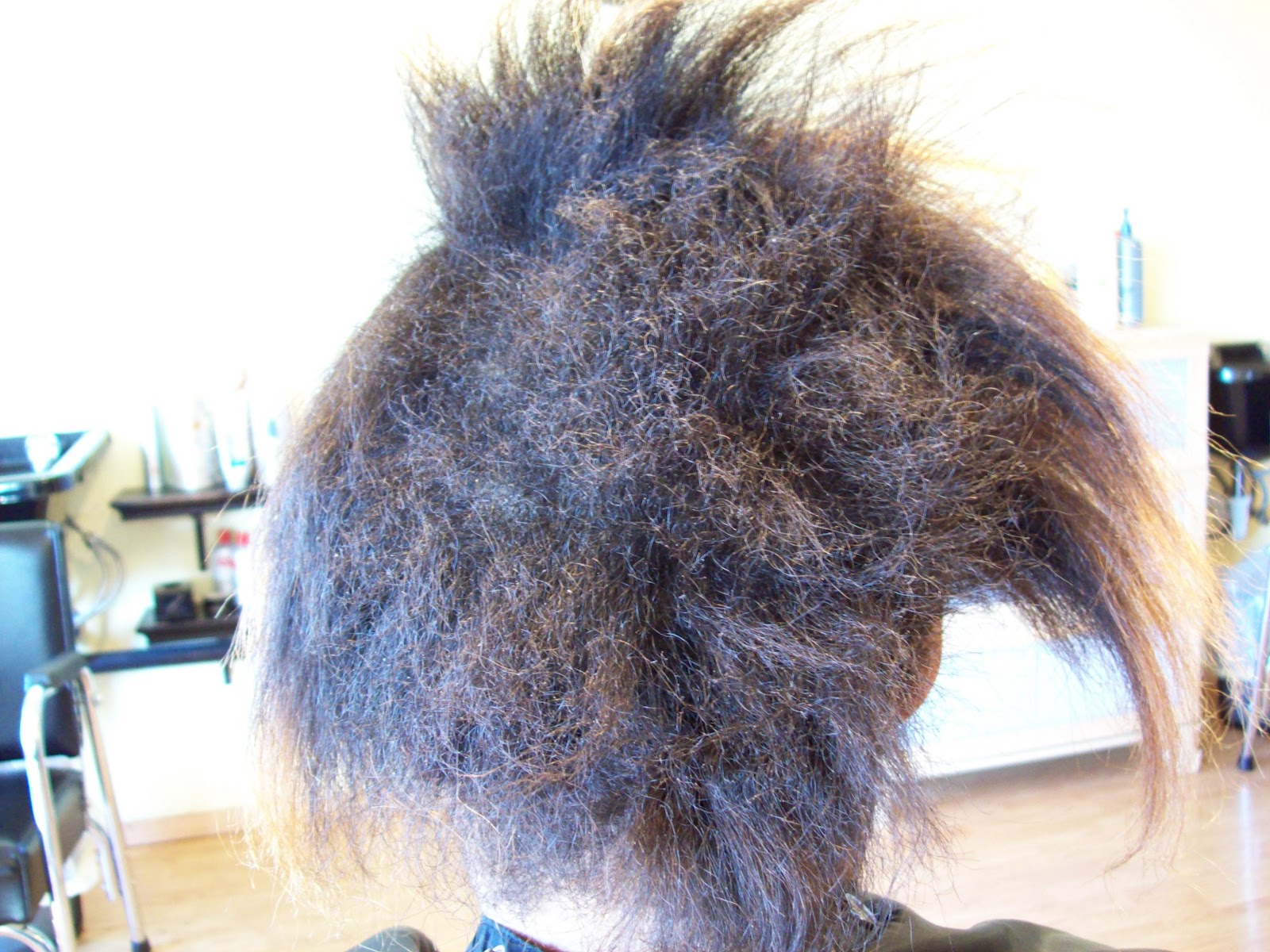 Severe Hair Breakage Severe Hair Breakage