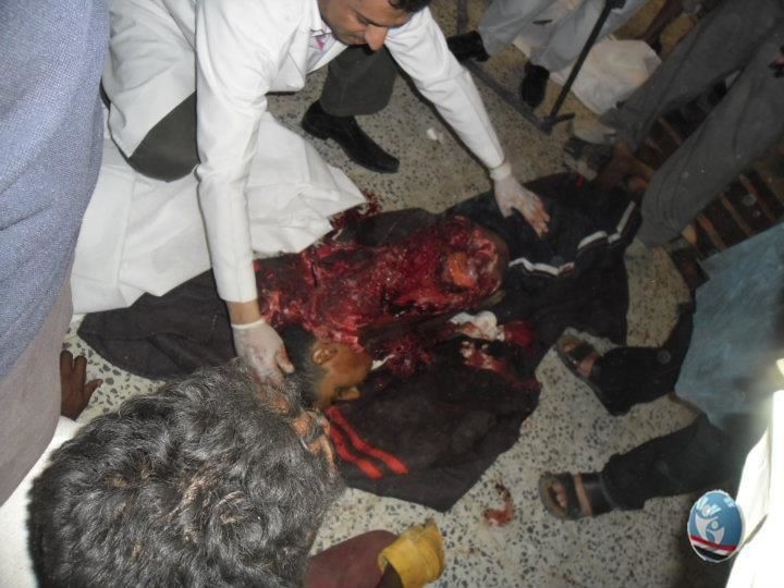 Yemen Rights Monitor: Sept 18-19th massacres - caution some images very