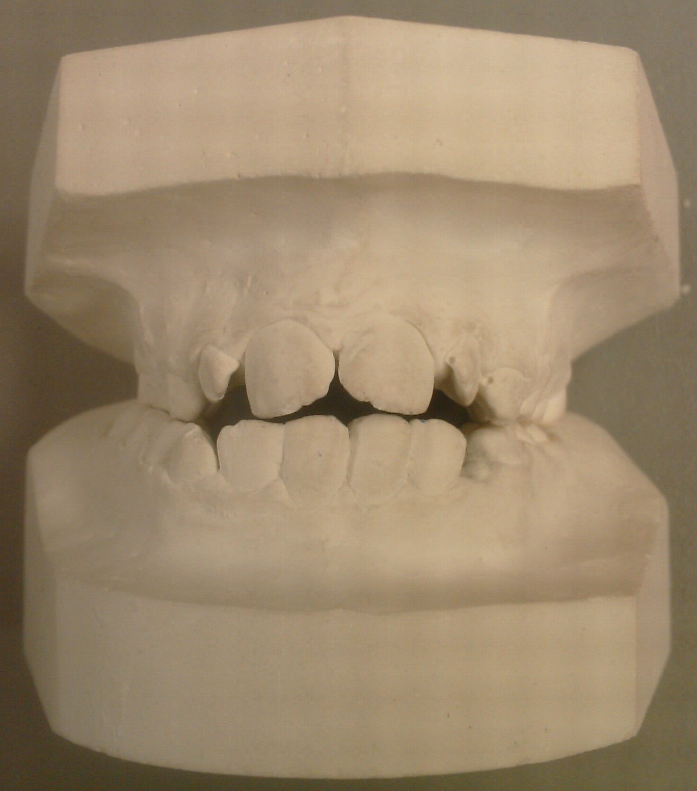Dentistry Analysis of the orthodontic models