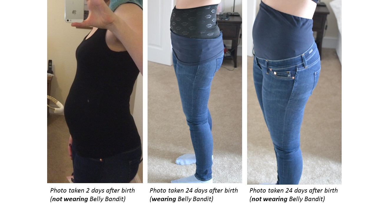 belly bandit after birth