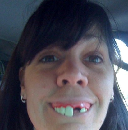 Funny teeth pics - ONLINE NEWS ICON