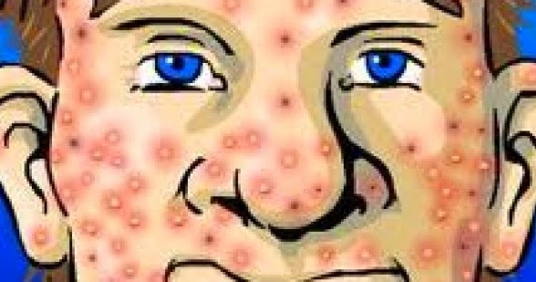 Come togliere il rossore di una pressione di faccia di posti