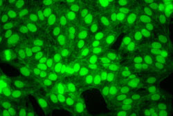 Antinuclear Antibody