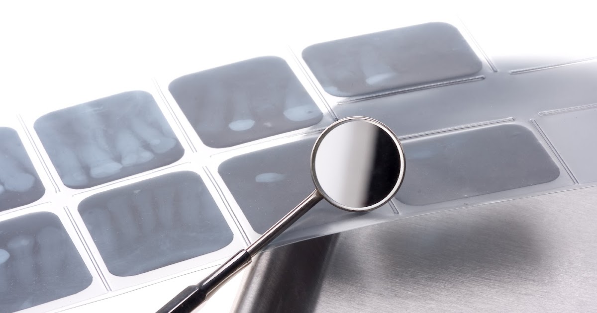 DiCiccio Orthodontics Can Dental Xrays cause Brain Cancer?