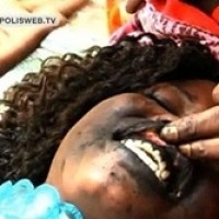Por sorriso bonito, mulheres tatuam gengiva de preto no Senegal 