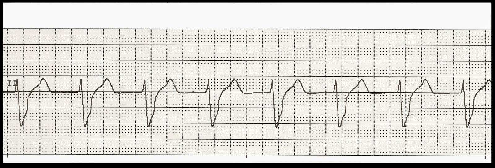 cath lab nurse