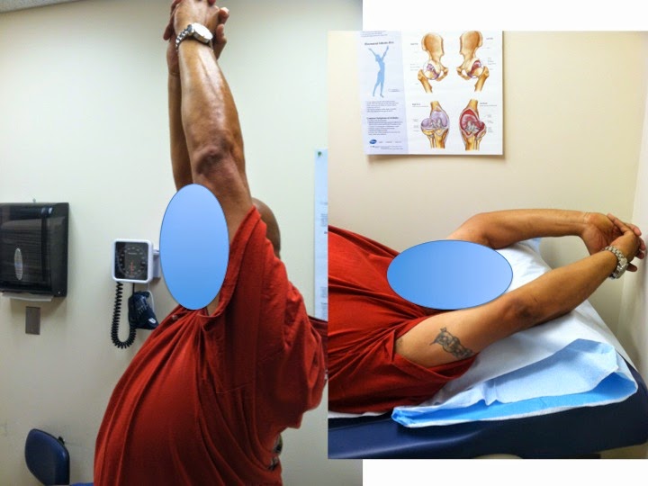 Shoulder and Elbow Surgery Three cases of rotator cuff surgery. Mini