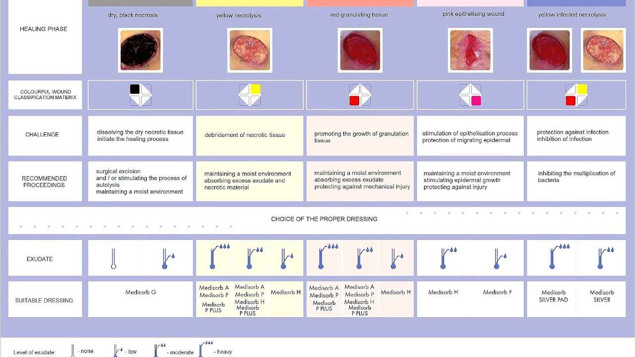 Sacral Pressure Ulcer Treatment Ulcer Choices