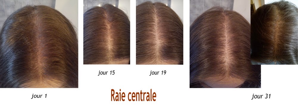 raie cheveux clairsemée raie cheveux clairsemée