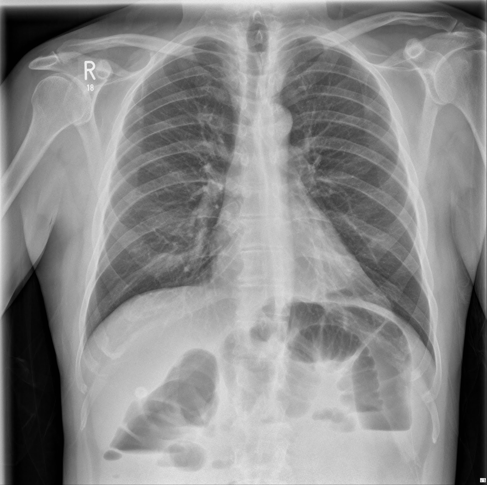 the xray doctor xrayoftheweek 13 can you pinpoint the site of pathology?