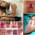 Jual Obat Wasir Herbal di Jamin Aman BPOM thumbnail