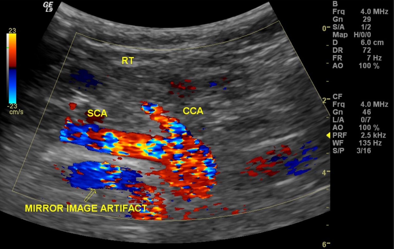About CT Scanner and Ultrasound April 2012