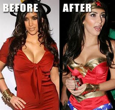  Kardashian  Plastic Surgery on Kim Kardashian Before And After Plastic Surgery
