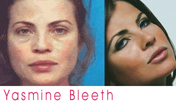 Hollywood Celebrities Without Makeup Pics