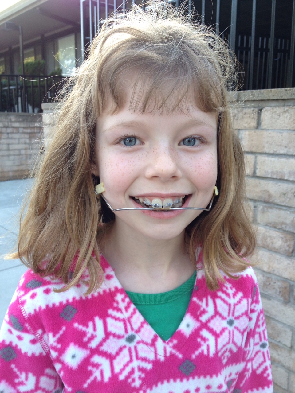 the second happiest place on earth braces