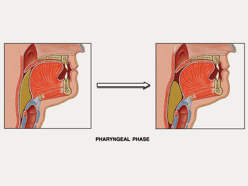 Mahasiswa Mekanisme Tersedak