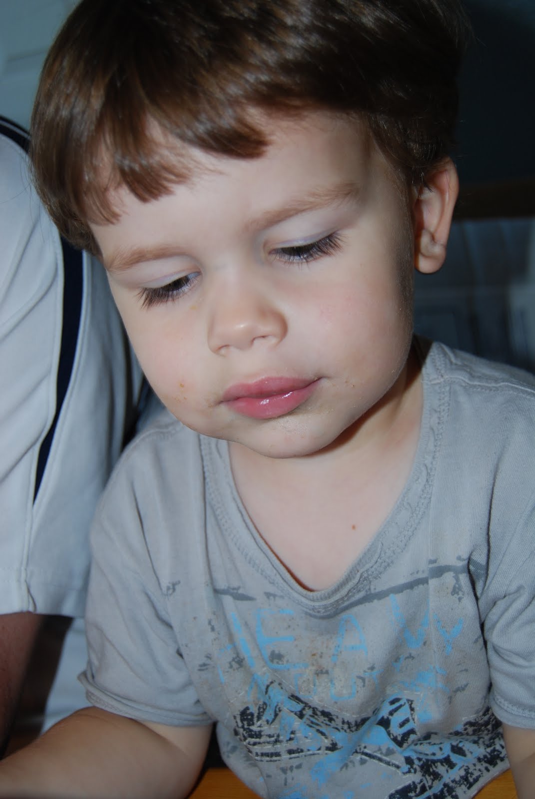 Busted Lip Treatment