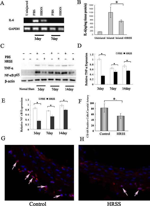 Balloon Induction Balloon Invitations Pictures