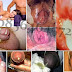 Gambar Vagina dan Penis Keluar Cairan Keruh Kental thumbnail