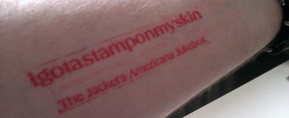 "I got a stamp on my skin"