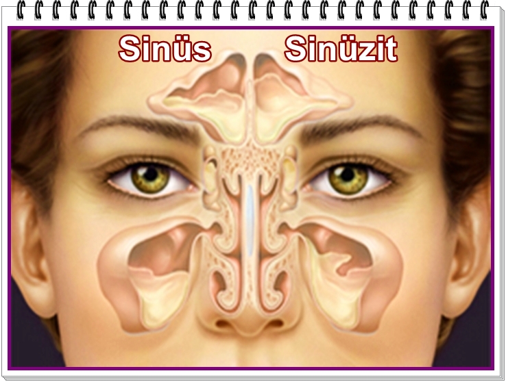 Ehil Kalem Sinüzit / Sinüs