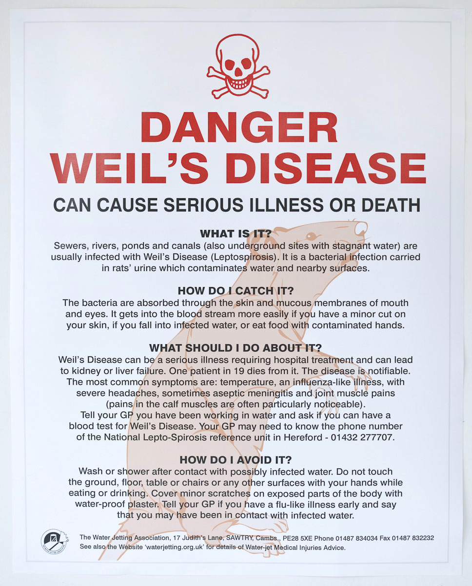 ULSTER HOSPITAL ICU CHARITY WALK Weils disease some facts