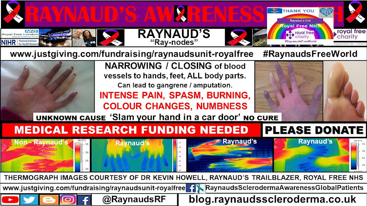 RaynaudsRF