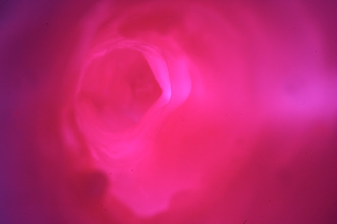 VIDEO UTERUS FLOWER