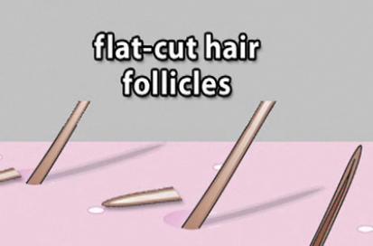 Beautysolutions87 Shaving Does Not Make Hair Grow Back Thicker Or
