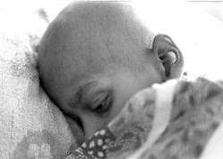 Niño con leucemia