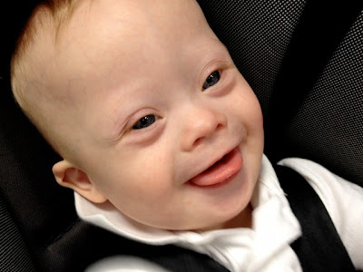 down-syndrome-smile-baby-kid-child-640x4