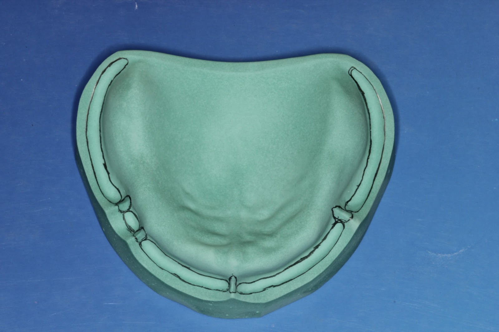 Step by step Guide for Understanding the Prosthodontics Anatomical