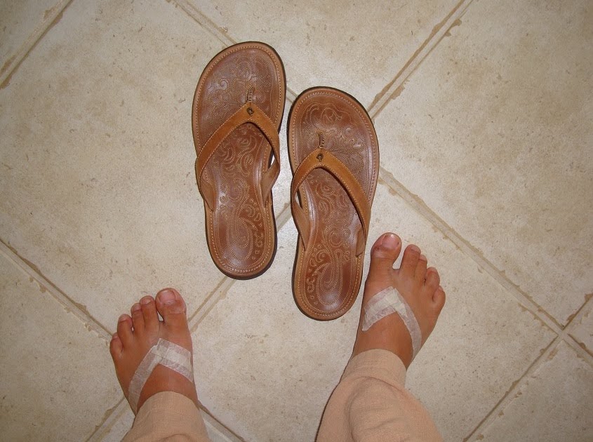 How to be Awesome, for Free: New Sandals Rubbing You the Wrong Way?